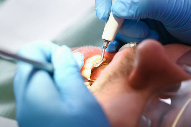 Best Weekend Emergency Dentist in Mitchellville, MD
